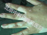 пưҽԺ