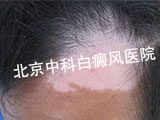 绤Щ
